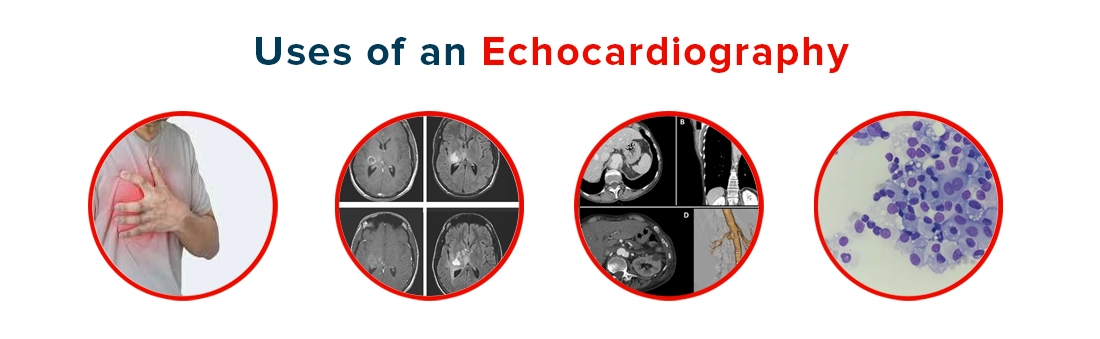 Uses of Echocardiography